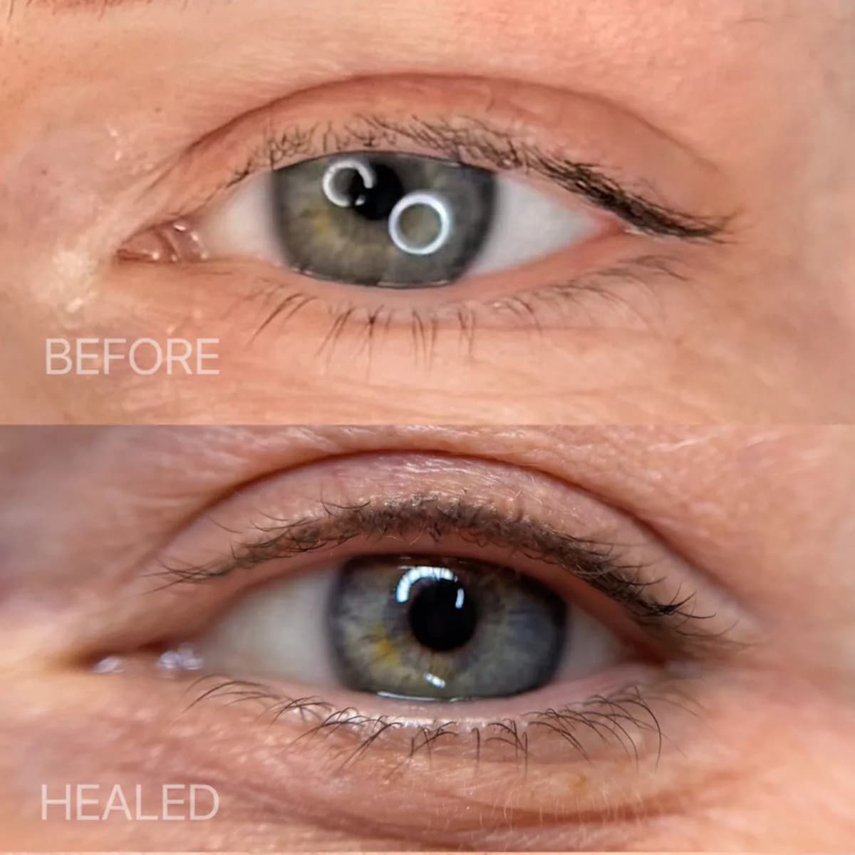 Lash Line Enhancement